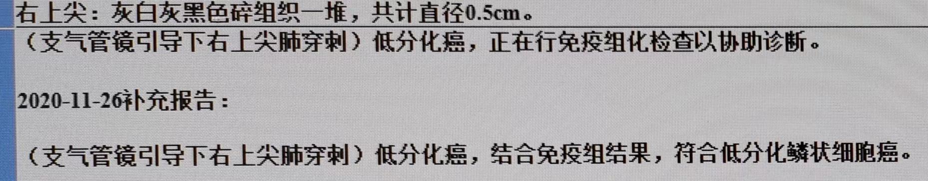 肺结节抗肿瘤治疗,肺结节诊治实例