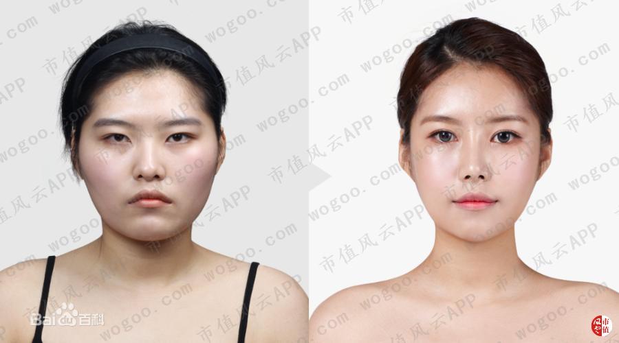 玻尿酸龙头华熙生物实时行情,聊聊玻尿酸龙头企业华熙生物