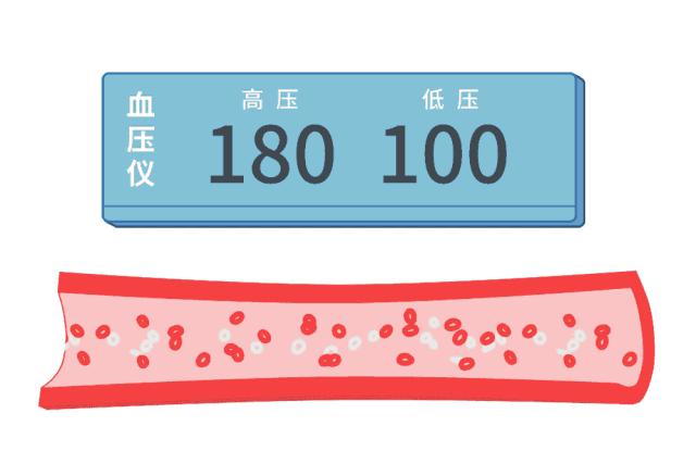 别让你的血压高高在上——基因检测实现高血压精准治疗