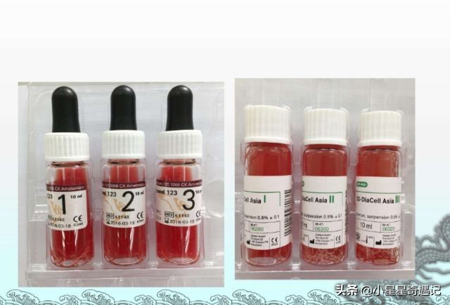 人类死亡后身体的恐怖变化,人类死之后身体会发生哪些变化