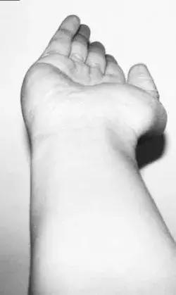 咏春拳摊膀伏教学,咏春拳摊膀伏厉害吗