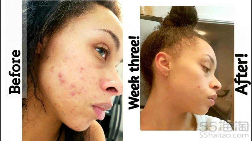 「5姐种草」平价“猛药”THEORDINARY有哪些口碑产品值得入手