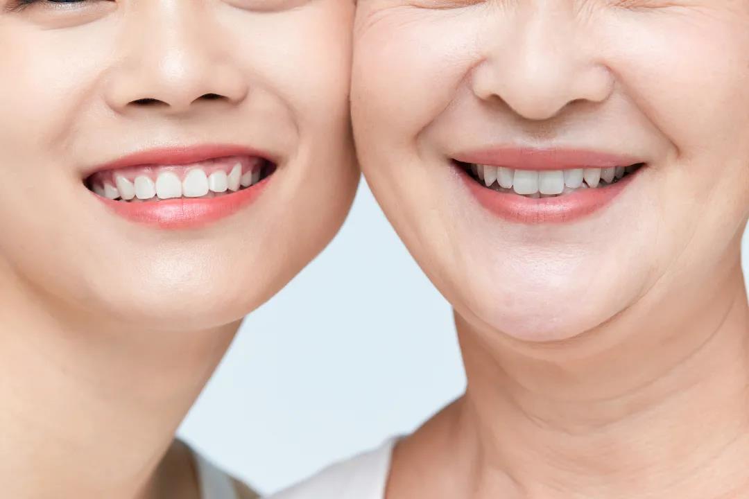 法令纹什么医美手段可以解决,法令纹严重怎么办30岁