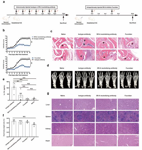 栗占国课题组发现类风湿关节炎新型生物标志物及其致病机制