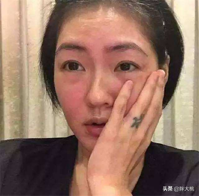 章子怡皮肤黑,章子怡脸色发黄怎么祛除