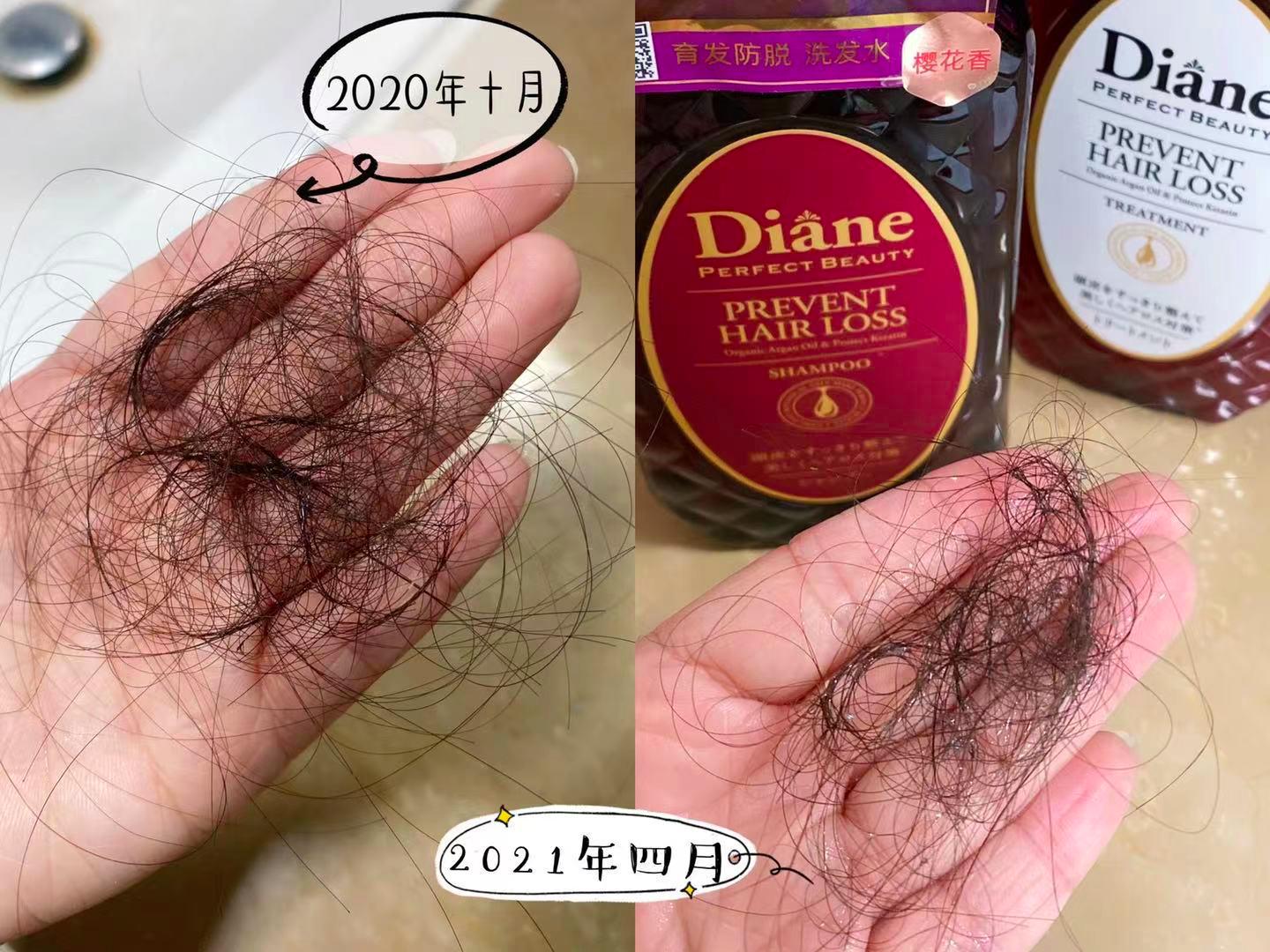 小宝宝脱发严重怎么办,拯救脱发小宝贝