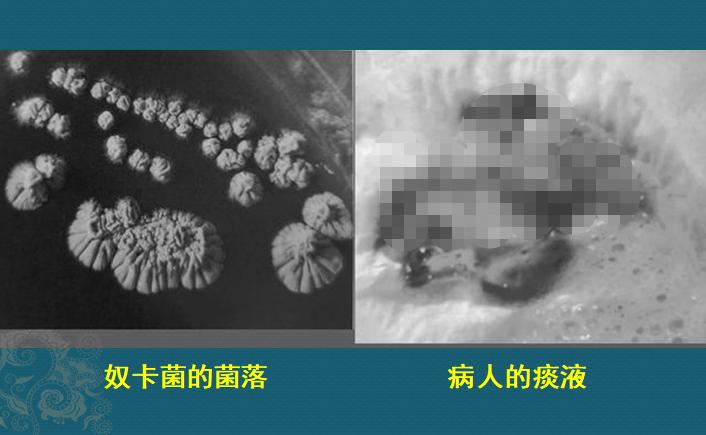 这个细菌提醒你，别买病死的鱼，它是个吃草的细菌，后来学会吃鱼