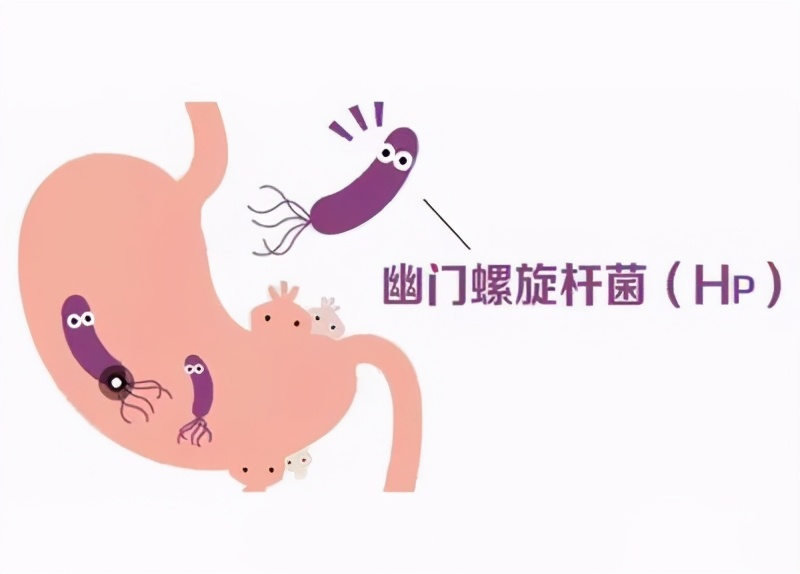 20多岁得胃癌的几率大吗,20多岁得胃癌的概率