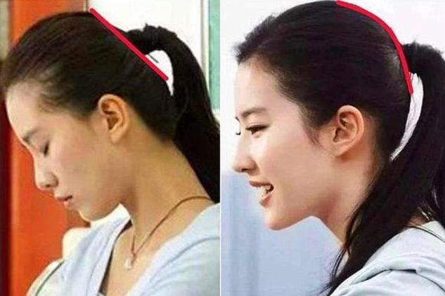 7个月的宝宝头睡扁了还能纠正吗,60天的婴儿后脑勺扁怎么矫正