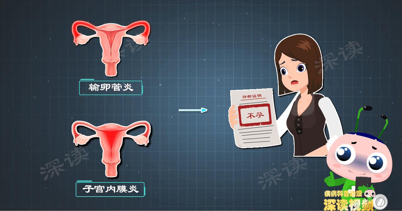 宫颈炎反复导致盆腔炎,盆腔炎宫颈炎不孕