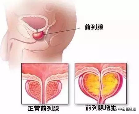 飞机吸尿救人的两位医生,医生在飞机上吸尿救人