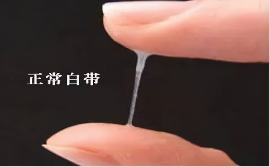 白带异常要如何做好预防的事情呢,白带检查能查出哪些问题