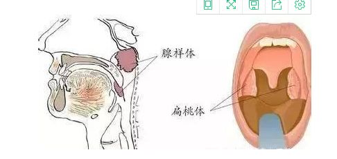 24年儿童高烧39度持续不退特效药,7岁男孩发高烧反反复复二天了