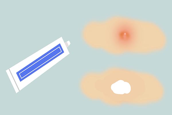 皮肤突然出现小红点怎么回事,皮肤有小红点跟肝病有联系吗