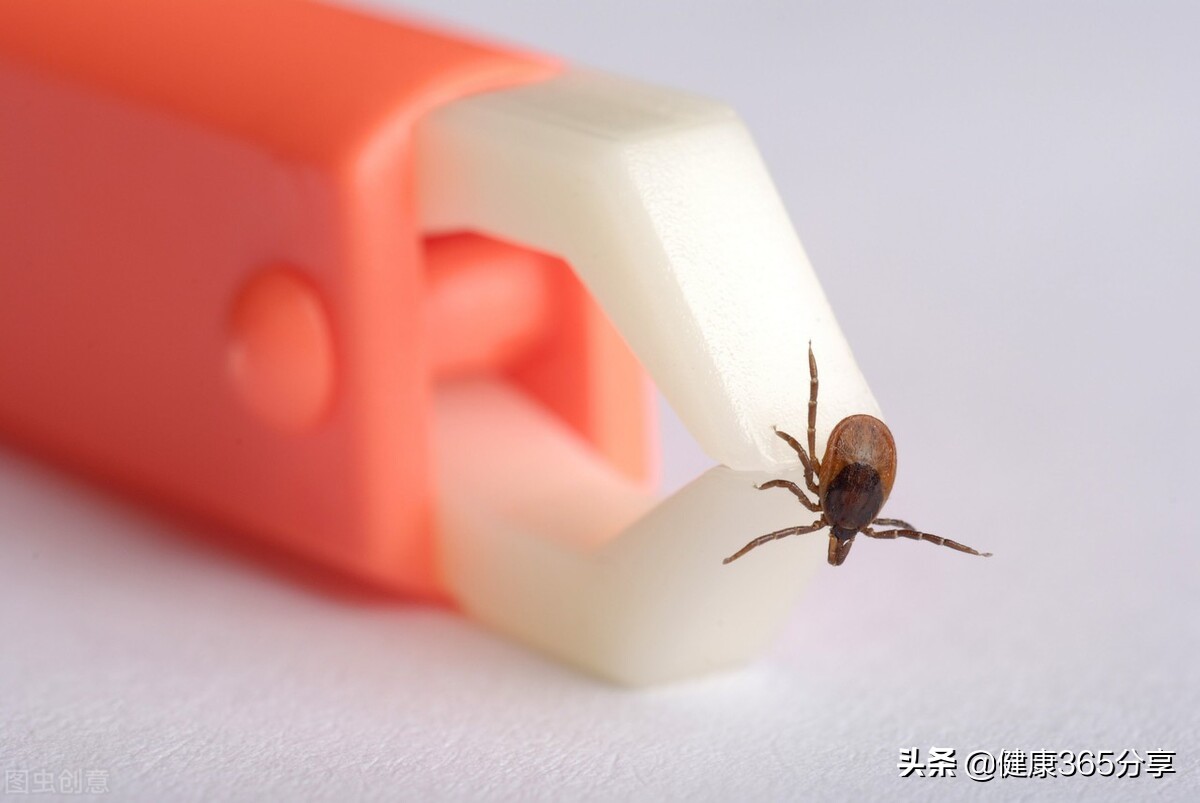 被虫子咬了要警惕四种病,被虫子咬了去看医生怎么治疗