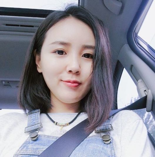 额头扁平怎么填充自然好看,额头颞部怎么填充好看