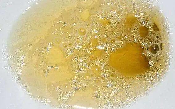 肾虚吃腰子能补肾吗,肾亏腰疼吃枸杞有用吗