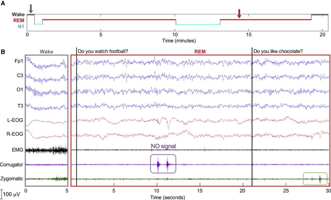 睡着了还能解数学题？研究发现，未来我们也许可以边睡觉边学习