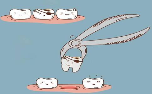 9岁孩子口内出现双排牙，怎么办｜莫急，口腔医生为你支一招