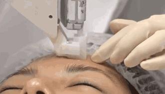 脸干的起皮敷面膜不管用怎么办,脸太干可以天天敷面膜吗