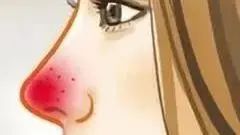 脸发红发烫小妙招有效改善红脸蛋,在暖气屋里脸发红发烫是怎么回事