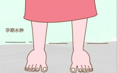 孕期水肿胖得像个球看谁都烦,孕期高血压而且水肿的厉害能顺不