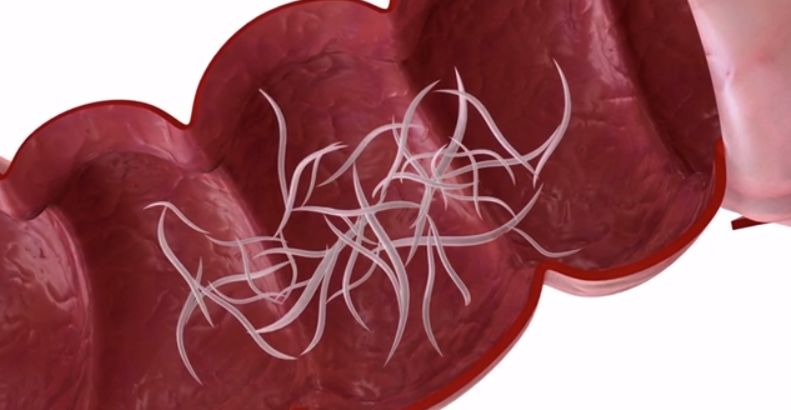 现在小学生要打虫吗,给小孩打虫的季节