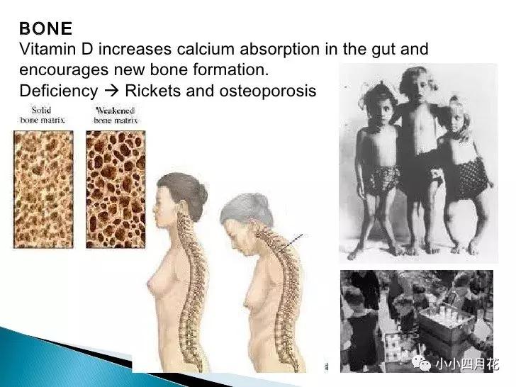 补充维生素d有用吗,补充维生素d的食物