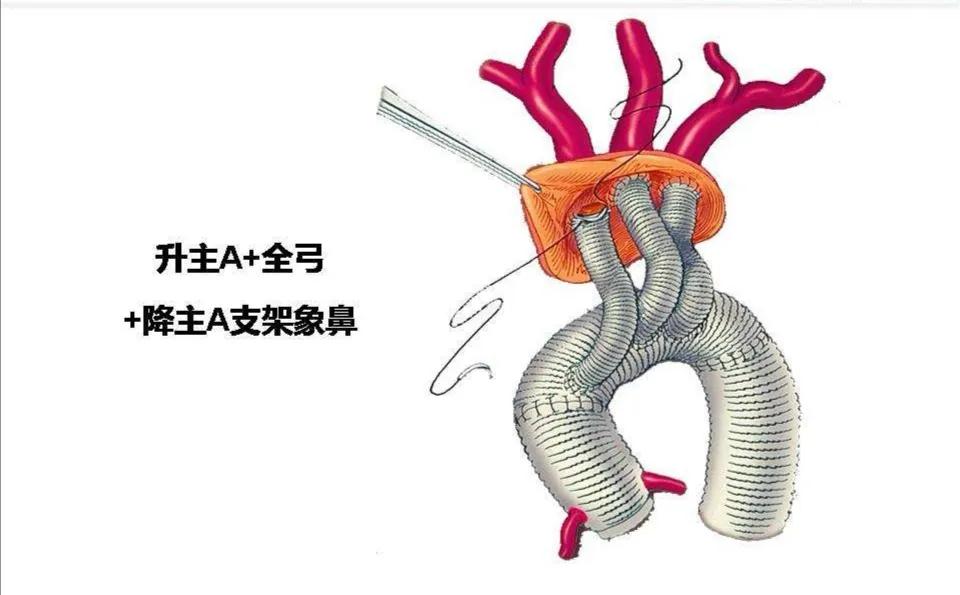 日照人民医院心外科排名,日照心脏病医院心内科哪个医生好