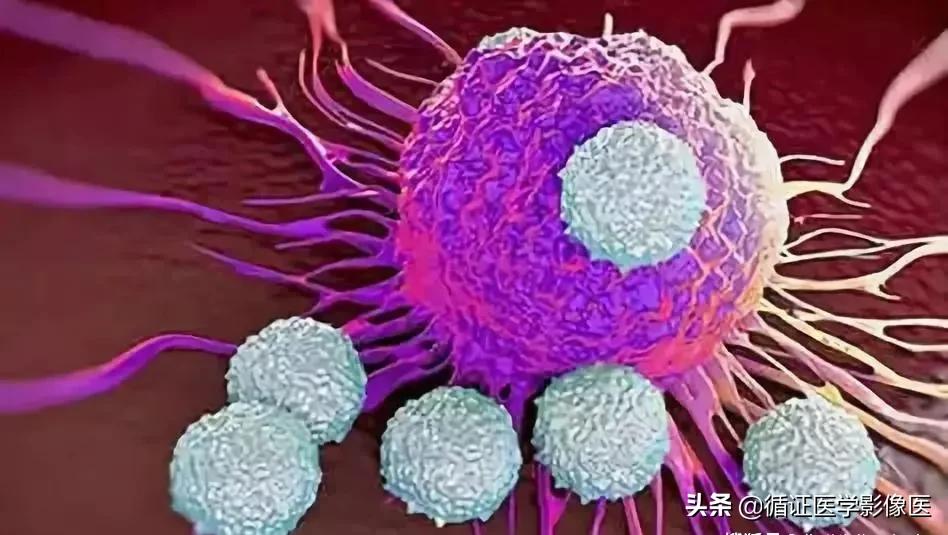 癌细胞战争,中国最新治疗癌细胞的消息