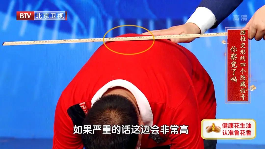 腰椎其中一节变形最好的治疗方法,腰椎轻度变形怎么治