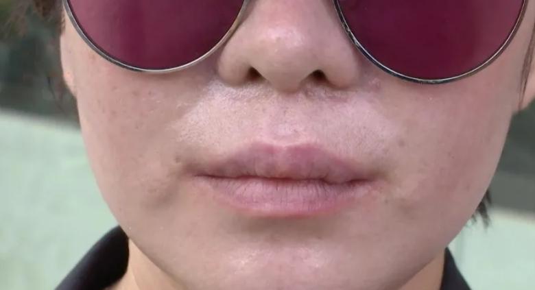 美容店老板娘整容,整容店老板娘翻车