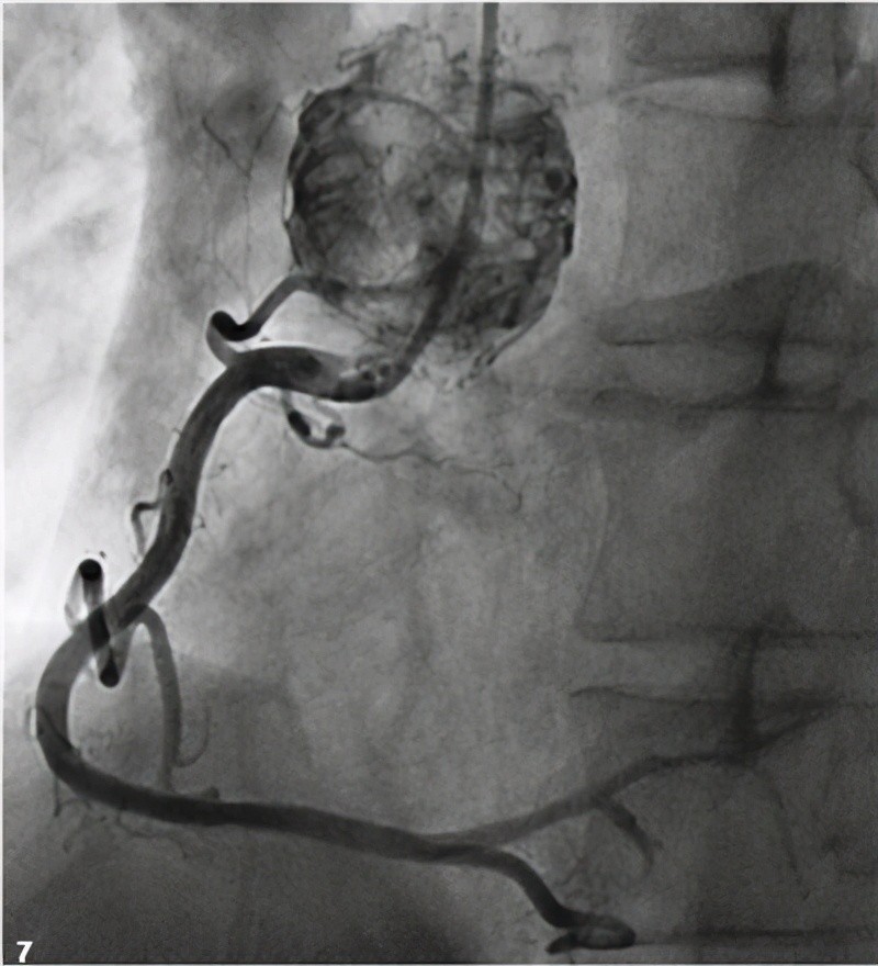 人类在太空中有什么,人体在太空会有什么变化
