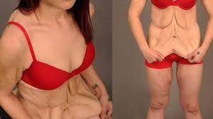 朋友圈卖的这种网红*肥药减**竟是*品毒**？想瘦的姑娘们，别再拿命赌了