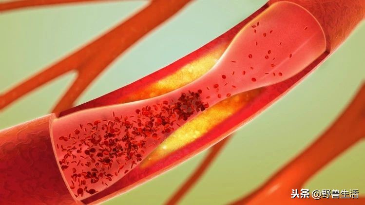 牛油果是真有营养还是虚假宣传,被捧上天却毫无作用的食物