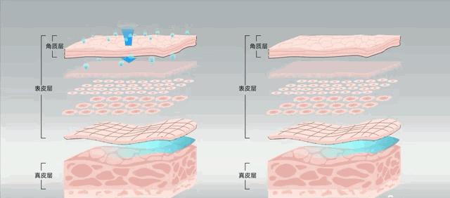 硬刚女皇龙妈也扛不住法令纹,2条沟壑让人心疼,贴一贴就消了