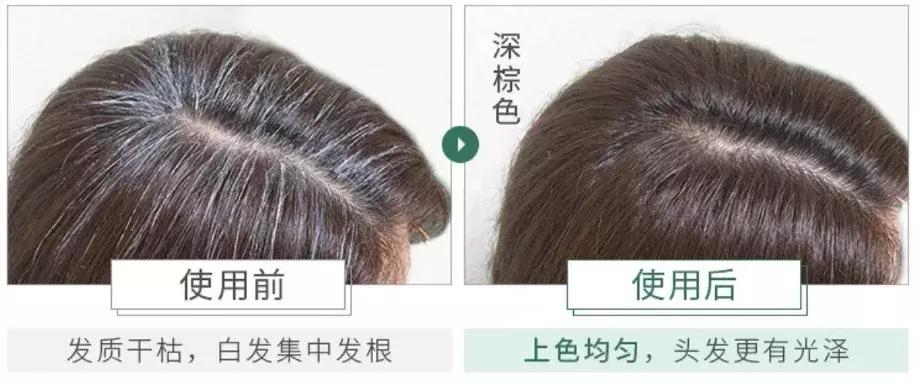 便宜又好用的日本药妆,日本代购好用的药妆推荐