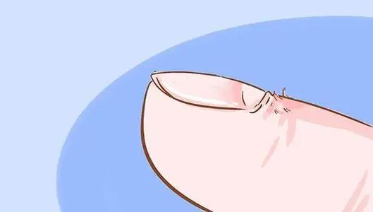 儿童指甲白斑坑洼不平是什么原因,8-12岁儿童指甲白斑是什么原因