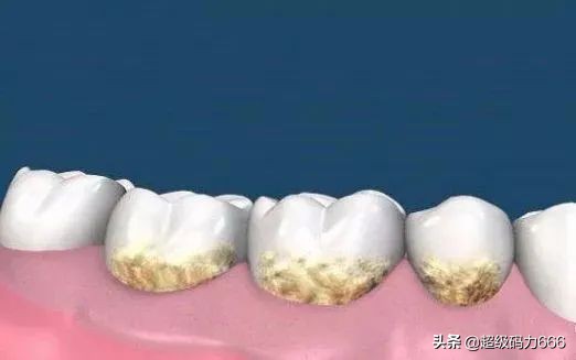 鍒风墮浼氫笂鐦句箞,澹版尝闇囧姩鐗欏埛鍒风墮