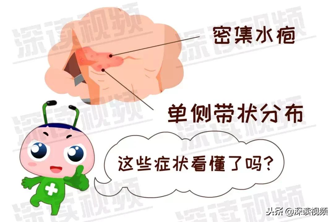 水痘和带状疱疹的关系你了解多少,水痘病毒引起的疱疹