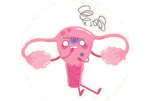 绝经一年多再来月经一定是癌症吗,绝经后有水样分泌物无味是癌症吗