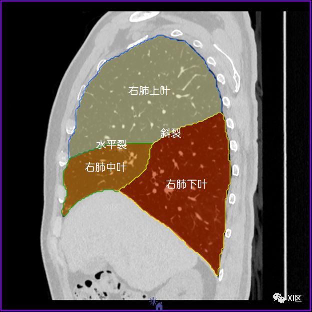 如此详细的肺部影像解剖，有点儿酷！