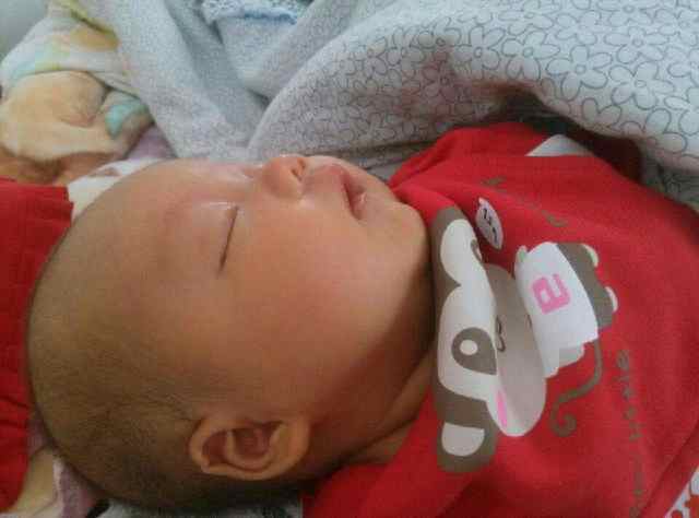 儿童脑袋中间凹下去是什么原因,小孩头顶凹下去一块是怎么回事