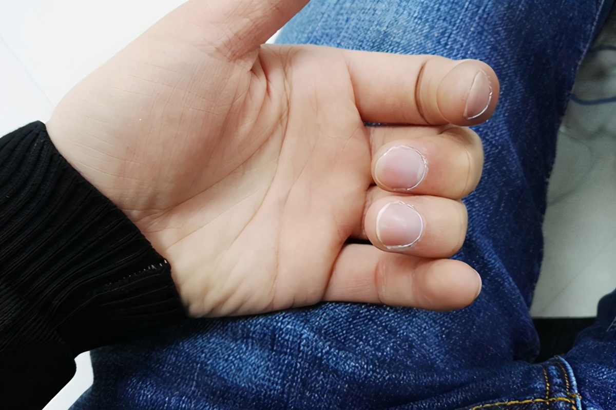 早上醒来后双手发胀五指握不紧,早晨起床感觉双手发胀是怎么回事