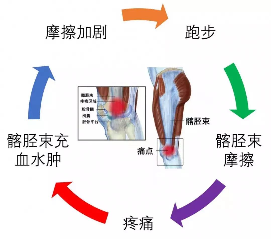 跑步大腿疼和小腿疼有什么区别,跑步之后脚跟疼怎么回事