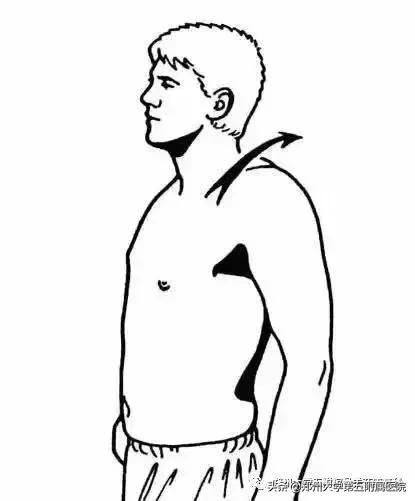 枕大神经痛是偏头疼吗,枕大神经痛能引起头痛吗