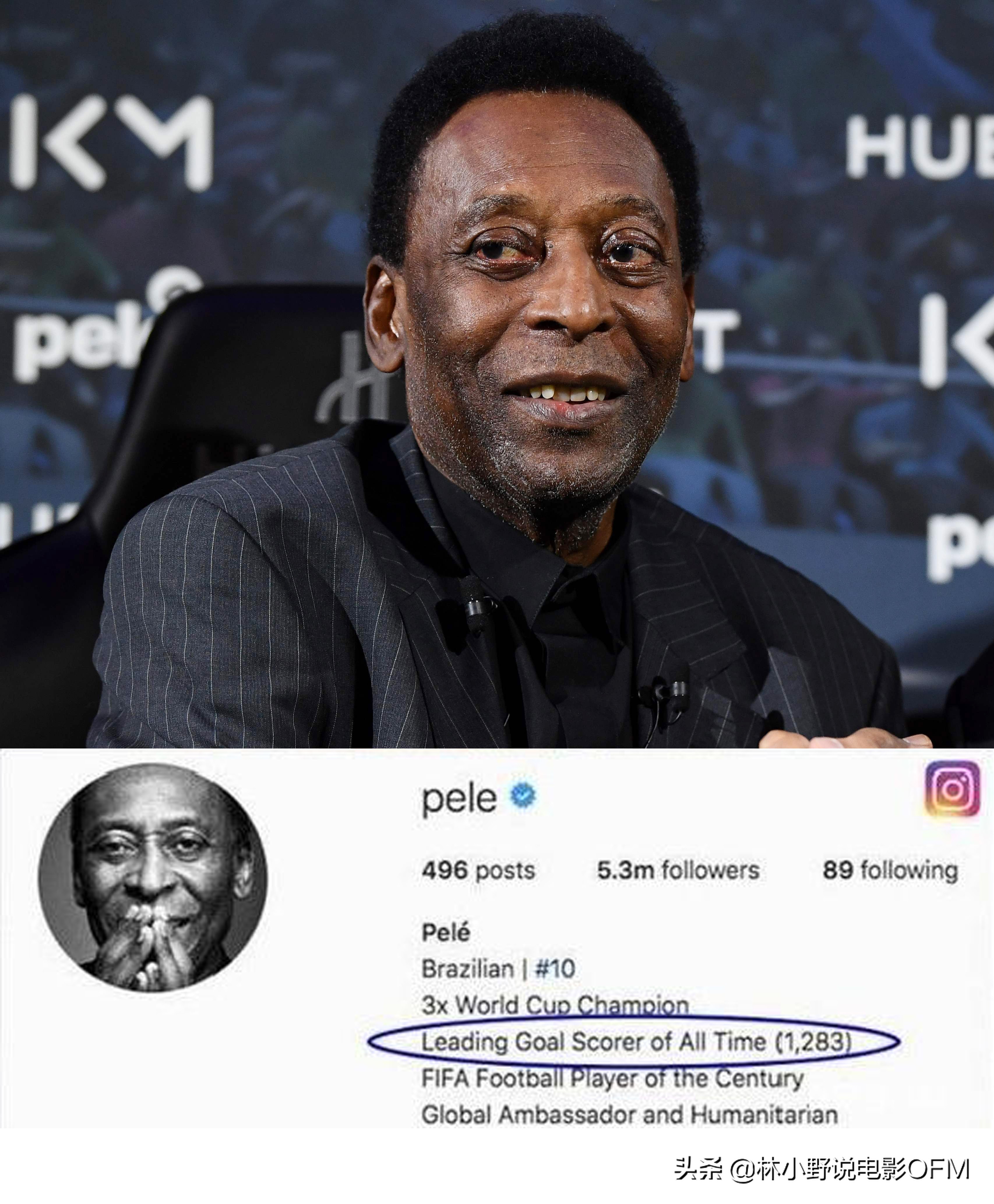 球王贝利和钟楚红合作拍广告,球王贝利与钟楚红的故事