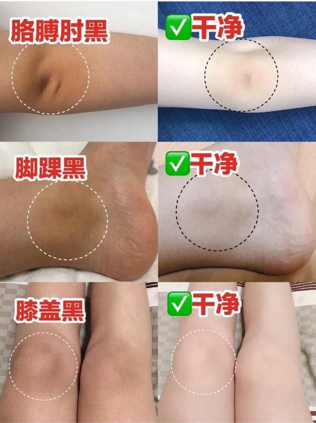 三伏天洗澡时,该不该用力搓泥灰?建议大家这样做,干净且卫生