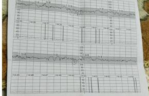 35周胎心监护120-180正常吗,孕34周胎心监护一直不合格不加速