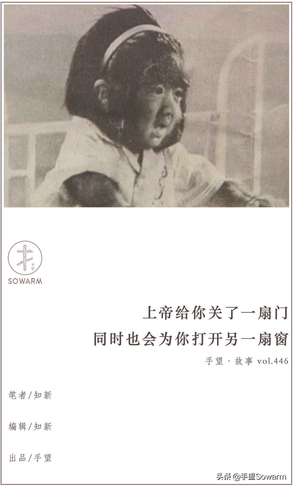 全世界体毛最多的人，是如何在歧视中逆袭为实力派歌手的？